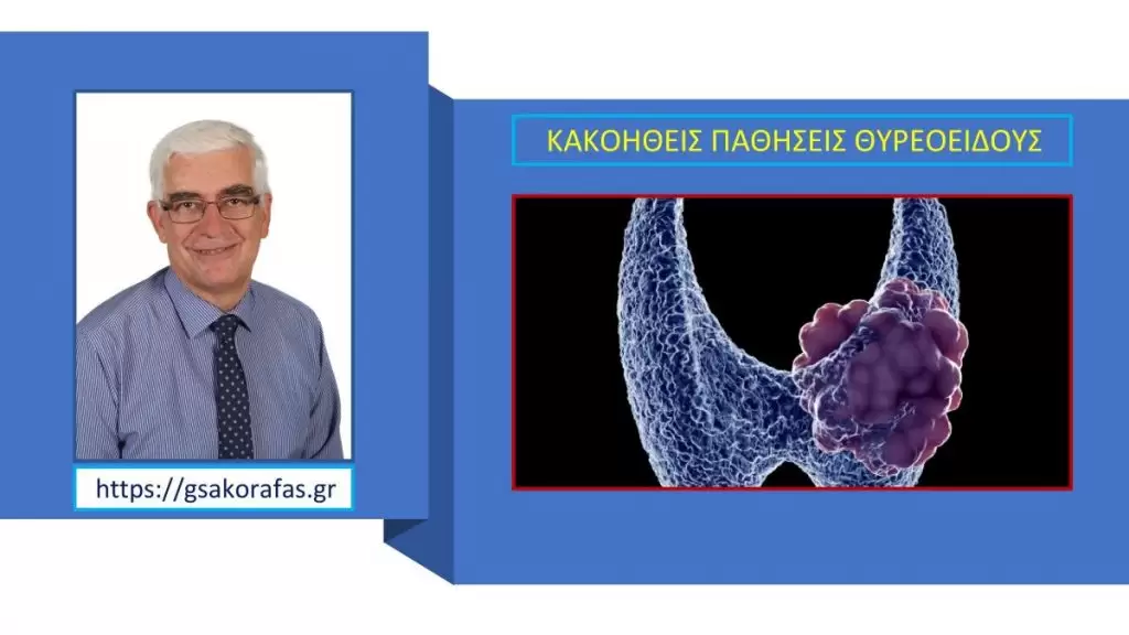 Θυρεοειδικοί Όγκοι: Πότε γίνονται επικίνδυνοι και πώς θεραπεύονται; 2 Θυρεοειδικοί Όγκοι: Πότε γίνονται επικίνδυνοι και πώς θεραπεύονται;