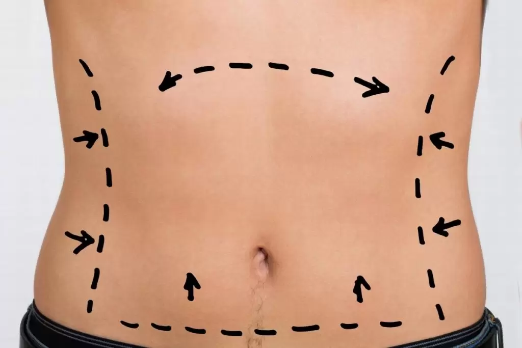 Ειδικές Συμβουλές για Όσους Ενδιαφέρονται για Επεμβάσεις Πλαστικής Χειρουργικής 2 Επεμβάσεις Πλαστικής Χειρουργικής