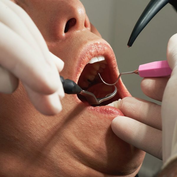 Dentist pass: Πώς θα πάτε δωρεάν τα παιδιά σας στον οδοντίατρο – ΕΔΩ η αίτηση