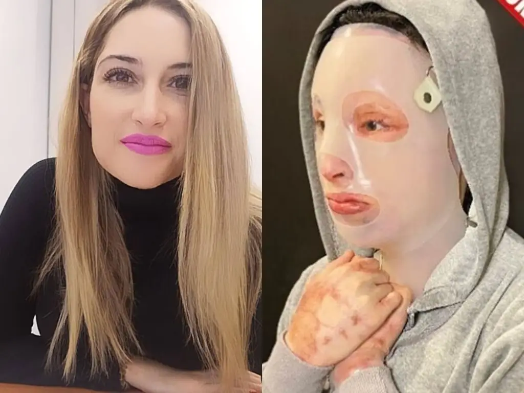 Επίθεση με βιτριόλι: Συγκλονίζει η Ιωάννα Παλιοσπύρου – Δείτε τι αποκάλυψε