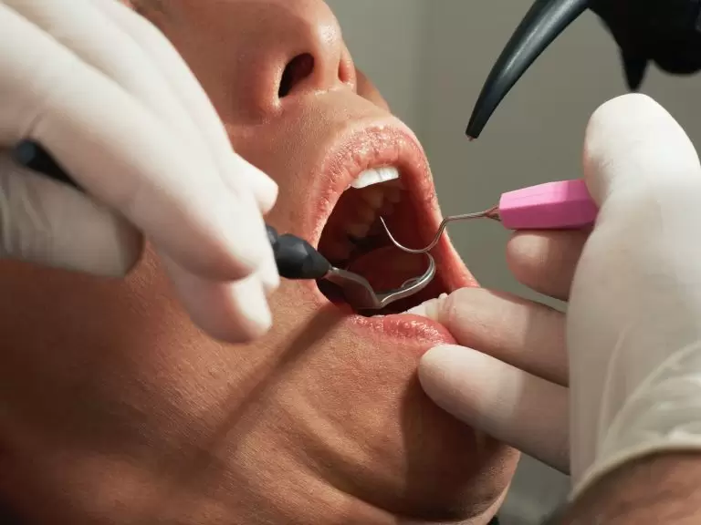 Dentist pass: Πώς θα πάτε δωρεάν τα παιδιά σας στον οδοντίατρο – ΕΔΩ η αίτηση