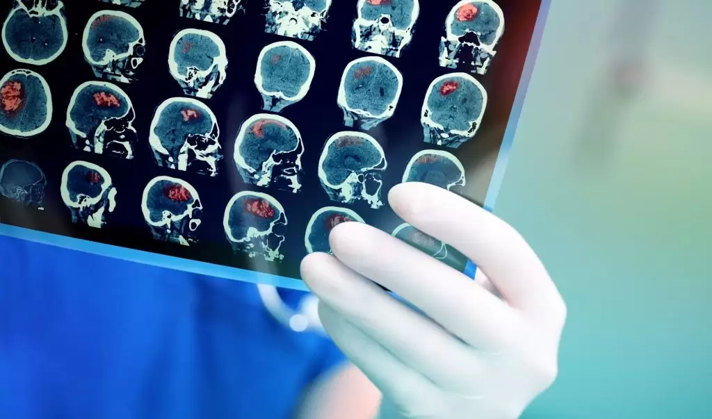 Καρκίνος: Έξι ύποπτα σημάδια που προειδοποιούν για τη νόσο – Τι πρέπει να κάνετε